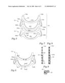 Four-leaflet stented mitral heart valve diagram and image