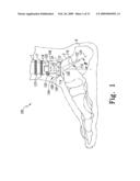 Modular Ankle Prosthesis and Associated Method diagram and image