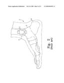 Modular Ankle Prosthesis and Associated Method diagram and image