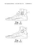 Modular Ankle Prosthesis and Associated Method diagram and image