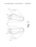 Modular Ankle Prosthesis and Associated Method diagram and image