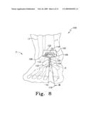 Modular Ankle Prosthesis and Associated Method diagram and image