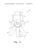 Modular Ankle Prosthesis and Associated Method diagram and image