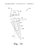 Modular Ankle Prosthesis and Associated Method diagram and image