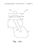 Modular Ankle Prosthesis and Associated Method diagram and image