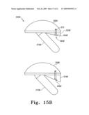 Modular Ankle Prosthesis and Associated Method diagram and image