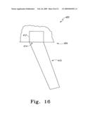 Modular Ankle Prosthesis and Associated Method diagram and image