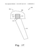 Modular Ankle Prosthesis and Associated Method diagram and image