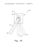 Modular Ankle Prosthesis and Associated Method diagram and image