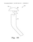 Modular Ankle Prosthesis and Associated Method diagram and image