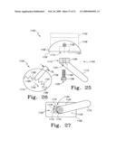 Modular Ankle Prosthesis and Associated Method diagram and image