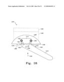 Modular Ankle Prosthesis and Associated Method diagram and image