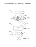 Modular Ankle Prosthesis and Associated Method diagram and image