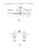 SYSTEMS AND METHODS FOR MINIMALLY-INVASIVE OPTICAL-ACOUSTIC IMAGING diagram and image