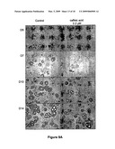 Use of 15-Lipoxygenase Inhibitors for Treating Obesity diagram and image