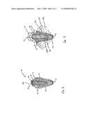 Monolithic Dental Implant With Natural Load Response diagram and image