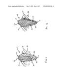 Monolithic Dental Implant With Natural Load Response diagram and image