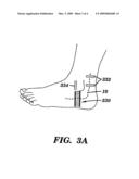 ELECTRO-OPTICAL SENSOR FOR PERIPHERAL NERVES diagram and image