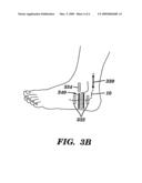 ELECTRO-OPTICAL SENSOR FOR PERIPHERAL NERVES diagram and image