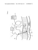 INSERTABLE ULTRASOUND PROBES, SYSTEMS, AND METHODS FOR THERMAL THERAPY diagram and image