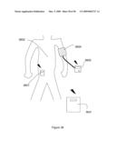 Control of Body Fluid Condition Using Diuretics, Based on Weight Measurement diagram and image