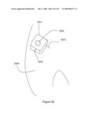 Control of Body Fluid Condition Using Diuretics, Based on Weight Measurement diagram and image