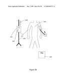 Control of Body Fluid Condition Using Diuretics, Based on Weight Measurement diagram and image