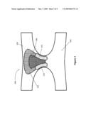 DISPOSABLE ANALGESIC AND LOCAL ANESTHETIC UNDERGARMENT diagram and image