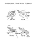 Combined sensor and infusion set using separated sites diagram and image