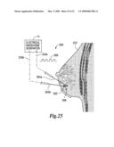 Electrical ablation surgical instruments diagram and image