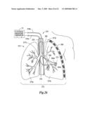 Electrical ablation surgical instruments diagram and image