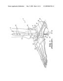 Modular, blade-rod, intramedullary fixation device diagram and image