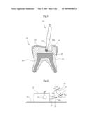 MEDICAL CUTTING TOOL MANUFACTURING APPARATUS AND METHOD diagram and image