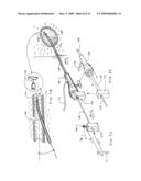 CLOSURE MEDICAL DEVICE diagram and image