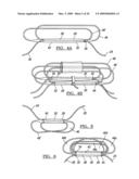 METHOD AND APPARATUS FOR COUPLING SOFT TISSUE TO BONE diagram and image