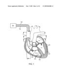 SELF-REFERENCING COMMUNICATION IN IMPLANTABLE DEVICES diagram and image