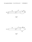 Method and apparatus for inspiratory muscle stimulation using implantable device diagram and image