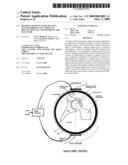 Method and device for treating osteoarthritis and cartilage disease, defects, and injuries in the human hip diagram and image