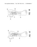 SYSTEMS AND METHODS FOR DELIVERING ELECTRICAL ENERGY IN THE BODY diagram and image