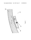 Devices, systems and methods to detect endothelialization of implantable medical devices diagram and image