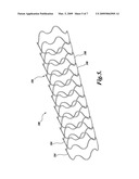 DYNAMIC STENT diagram and image