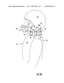 Apparatus for reducing brain and cervical spine injury due to rotational movement diagram and image