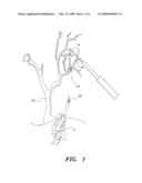 Hydraulic Crane-Mounted Remotely-Controlled Lifting Device diagram and image