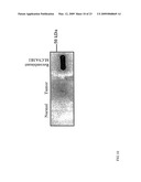 SLC9A3R1 DIRECTED DIAGNOSTICS FOR NEOPLASTIC DISEASE diagram and image