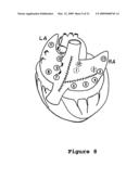 COMPOSITIONS AND METHODS FOR PERFORMING REVERSE GENE THERAPY diagram and image