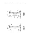 Ultrasonic Synthetic Transmit Focusing With a Multiline Beamformer diagram and image