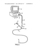 Coronary sinus access catheter with forward-imaging means diagram and image