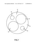 Coronary sinus access catheter with forward-imaging means diagram and image