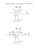 Methods And Devices For Fractional Ablation Of Tissue For Substance Delivery diagram and image