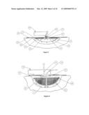 APPARATUS FOR CLEANSING WOUNDS WITH MEANS FOR SUPPLY OF THERMAL ENERGY TO THE THERAPY FLUID diagram and image